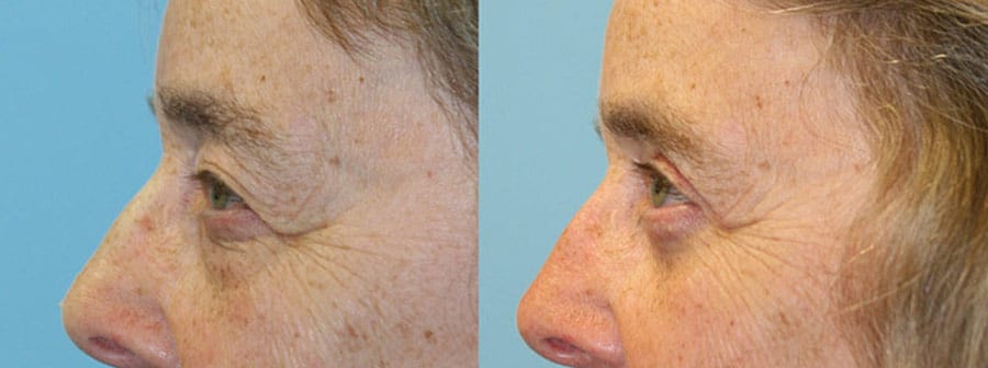 Before and After Image