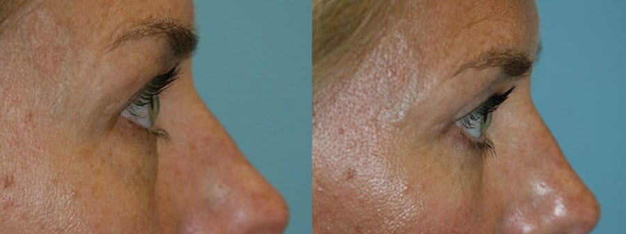 Before and After Image