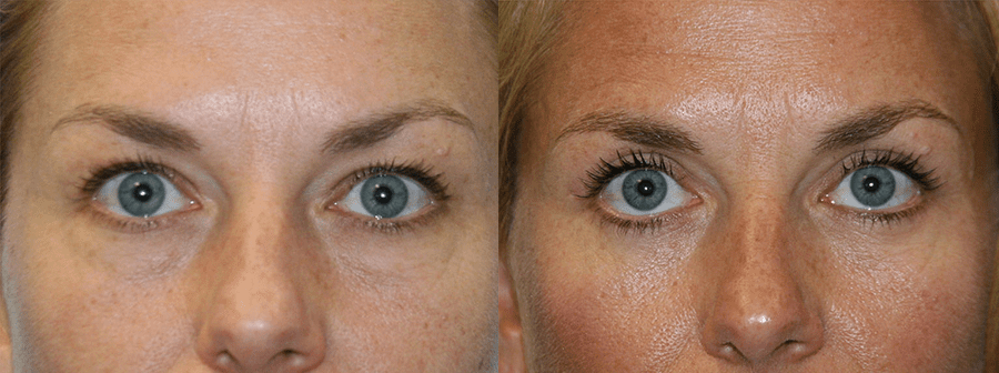 Before and After Image