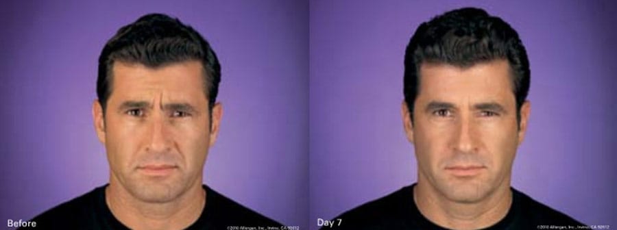 Before and After Image