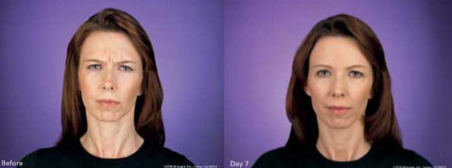 Before and After Image