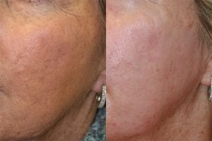 Before and After Image