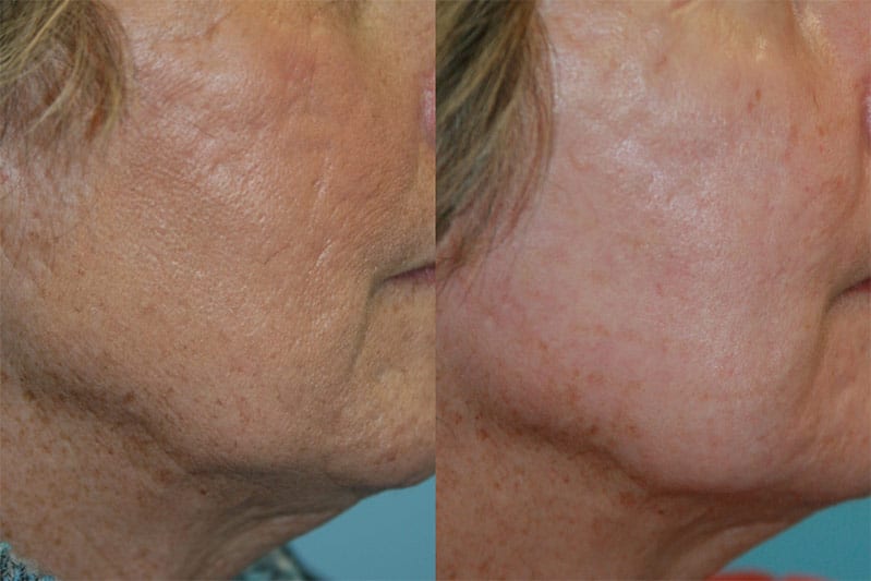 Before and After Image