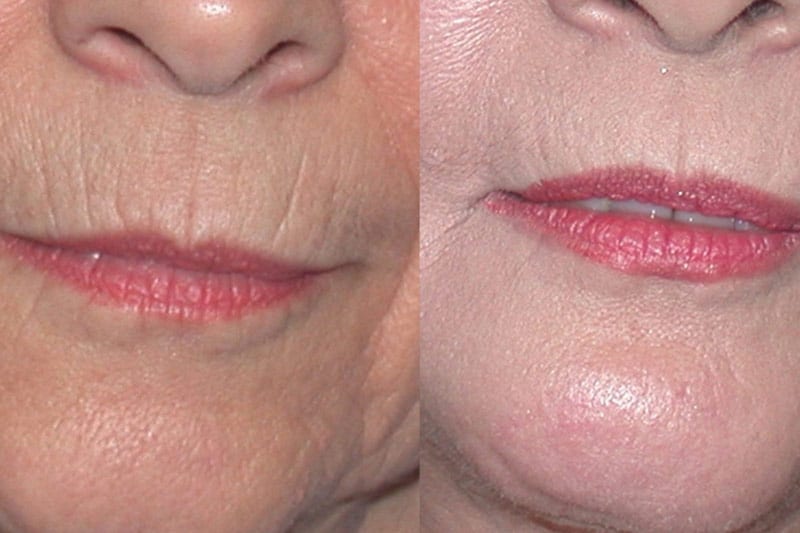 Before and After Image