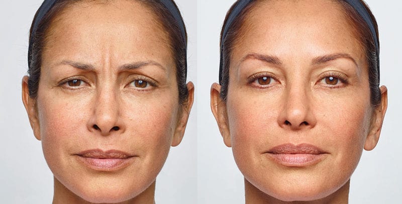 Before and After Image