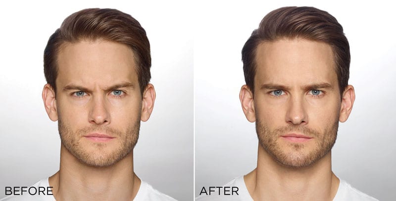 Before and After Image