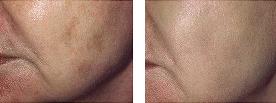 Before and After Image