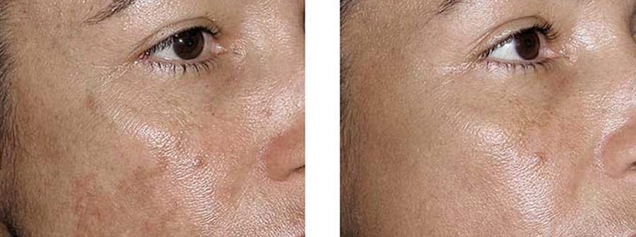 Before and After Image