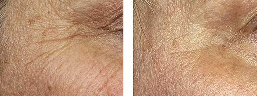 Before and After Image