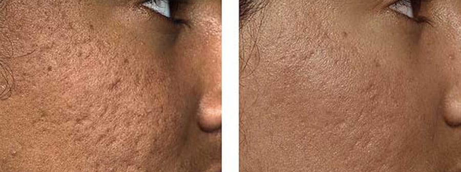 Before and After Image