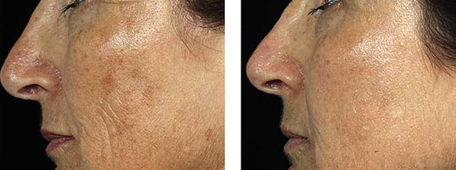 Before and After Image