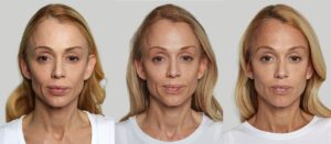 Before and After Image