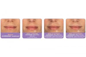 Before and After Image