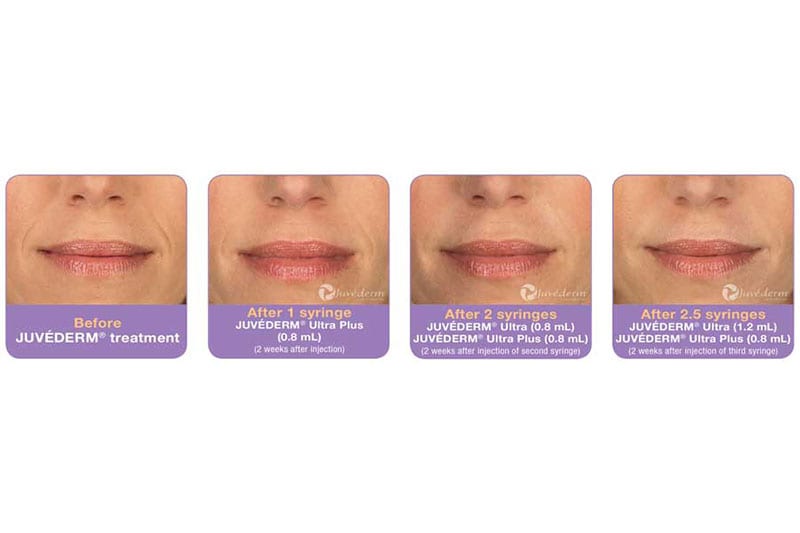 Before and After Image