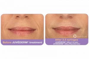 Before and After Image