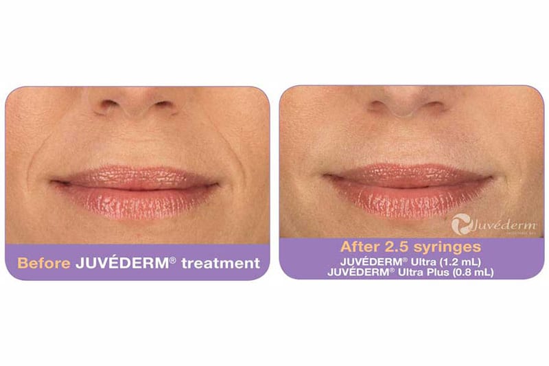 Before and After Image