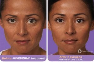 Before and After Image