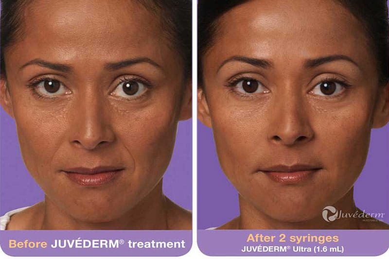 Before and After Image