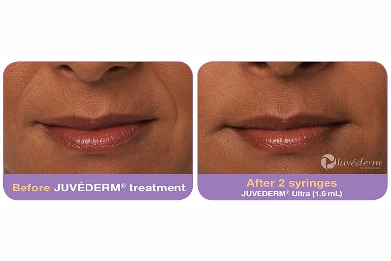 Before and After Image