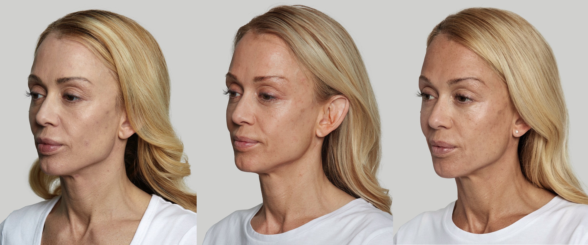 Before and After Image