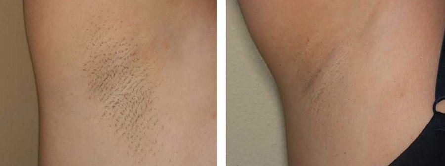 Before and After Image