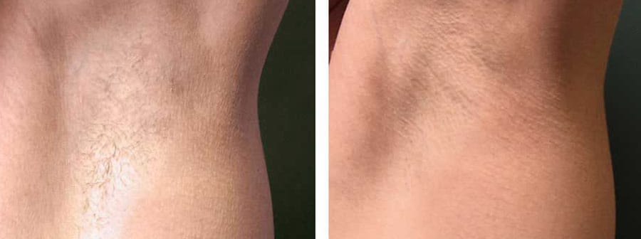 Before and After Image