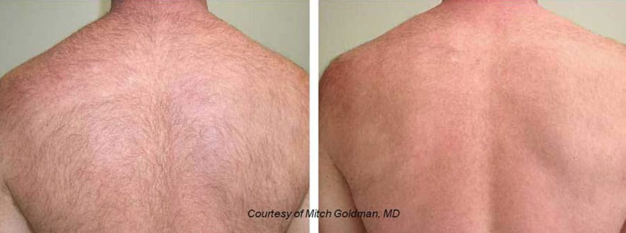 Before and After Image