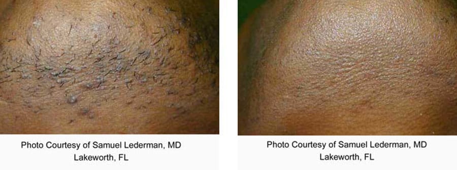 Before and After Image