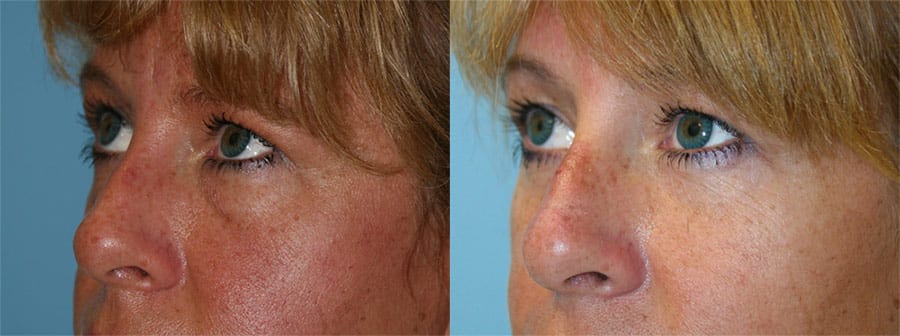 Before and After Image