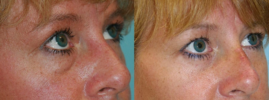 Before and After Image