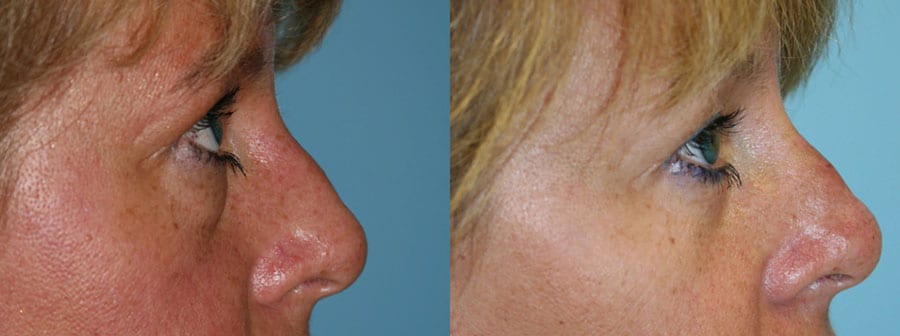 Before and After Image