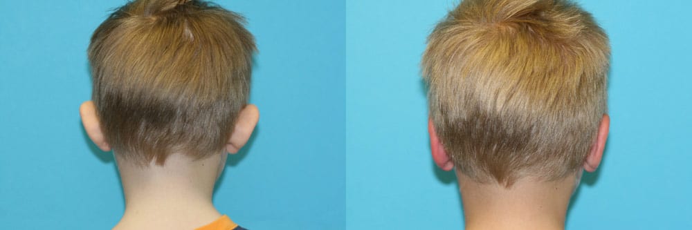 Before and After Image