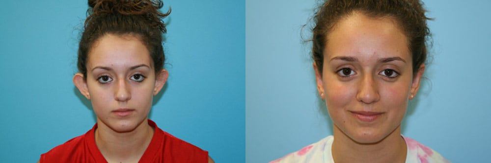 Before and After Image