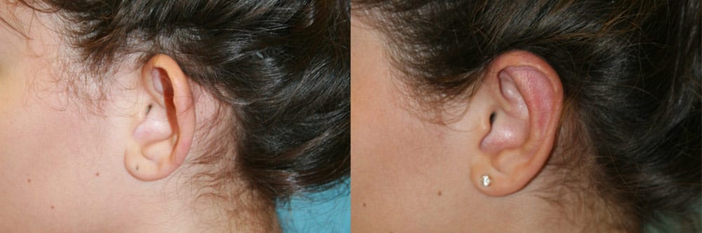 Before and After Image