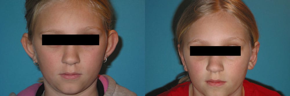 Before and After Image