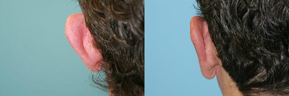 Before and After Image