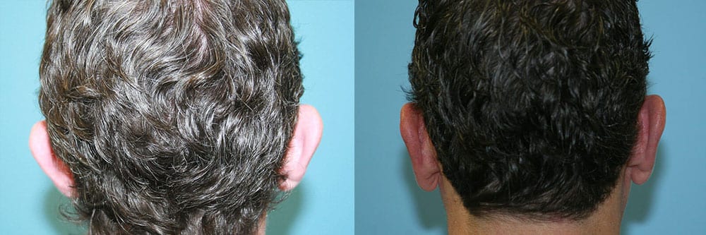 Before and After Image