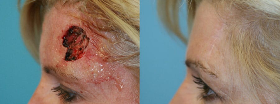 Before and After Image