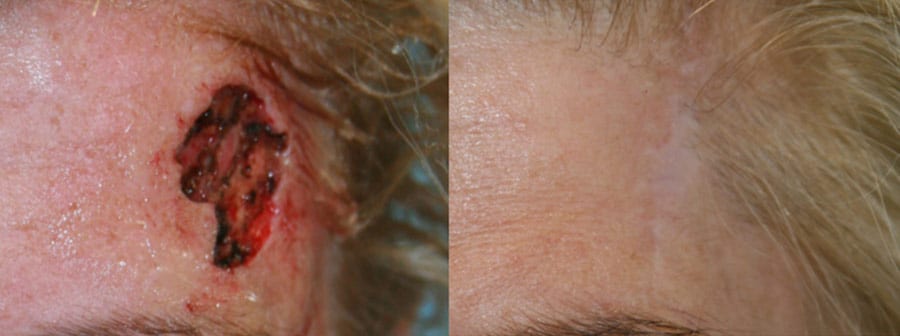 Before and After Image