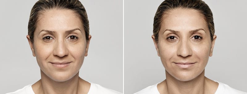 Before and After Image