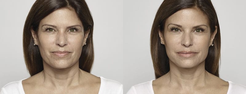 Before and After Image