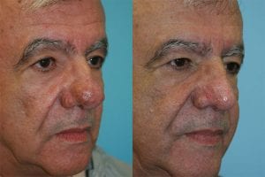 Before and After Image