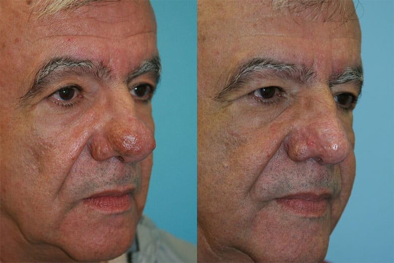 Before and After Image