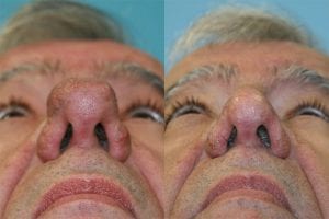 Before and After Image