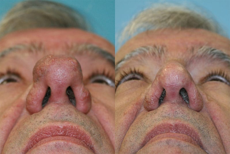 Before and After Image