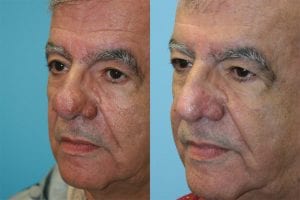 Before and After Image