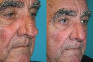 Before and After Image