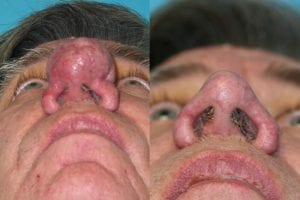 Before and After Image