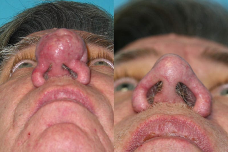 Before and After Image