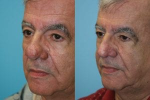 Before and After Image